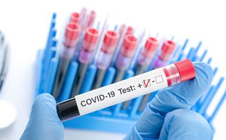 Reagensglas med positiv Covid-19 test 